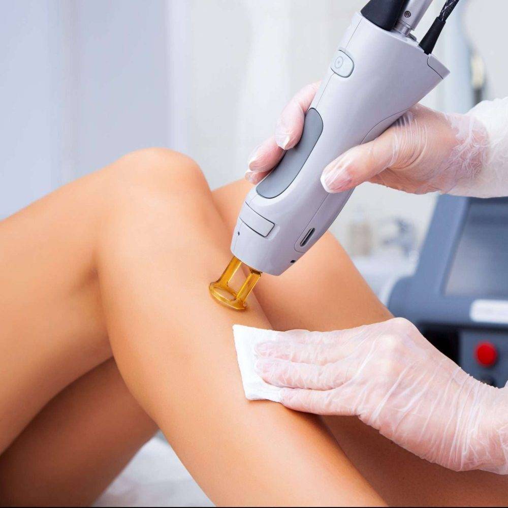 Enthaarung Laser Bremen Enthaarung Laser Bremen