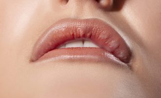 Hyaluronidase Behandlung bei Knötchen in der Lippe Hylase Knoten